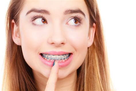 best orthodontist near 10930|The best UK Orthodontists in 2024